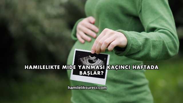 Hamilelikte Mide Yanması Kaçıncı Haftada Başlar?