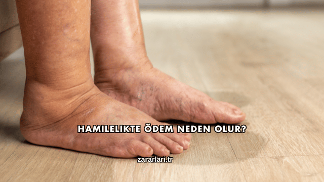 Hamilelikte Ödem Neden Olur?
