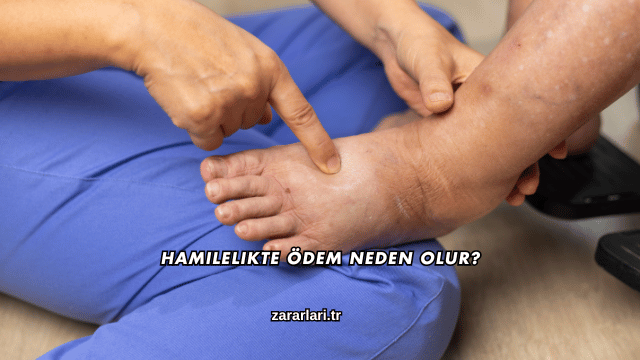 Hamilelikte Ödem Neden Olur?