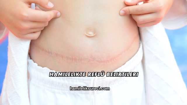 Hamilelikte Reflü Belirtileri