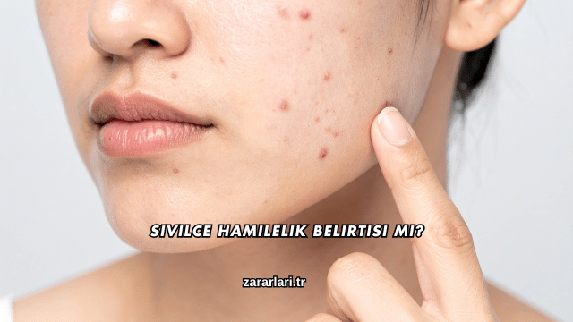 Sivilce Hamilelik Belirtisi mi?